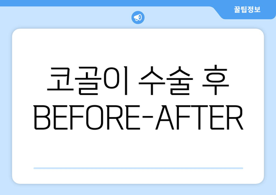 코골이 수술 후 BEFORE-AFTER