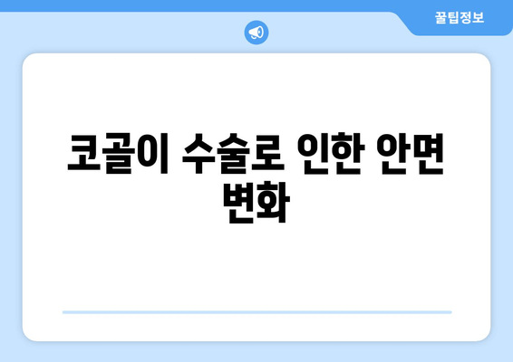 코골이 수술로 인한 안면 변화