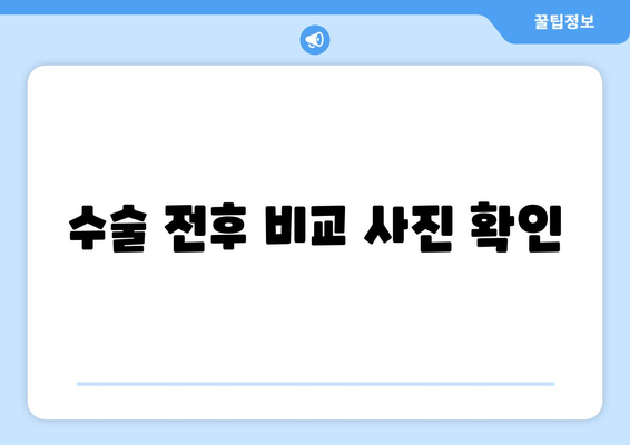 수술 전후 비교 사진 확인