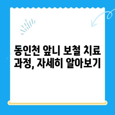 동인천 앞니 보철 치료, 최고의 선택을 위한 가이드 | 동인천 치과, 앞니 보철, 치아 상실, 심미 치료, 치료 과정, 비용, 추천