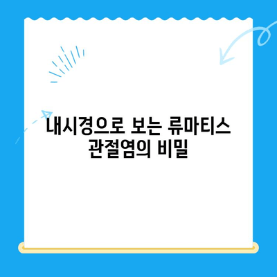 류마티스 관절염 vs. 무릎관절염| 내시경으로 정확하게 감별하는 방법 | 관절염, 진단, 내시경 검사