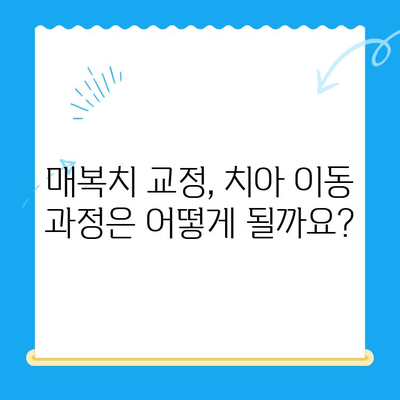 경주 치과| 매복치, 본래 자리로 돌려놓는 방법 | 매복치 교정, 치아 이동, 경주 치과 추천