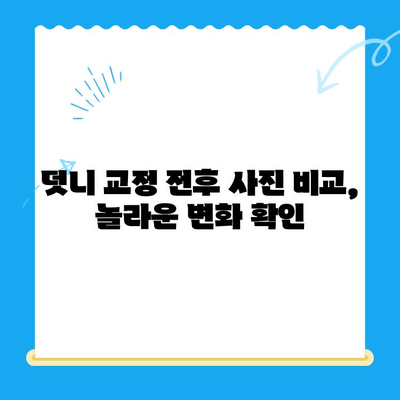 경주 덧니 교정 치료 성공 사례| 환자별 맞춤 치료 결과 공개 | 경주 치과, 덧니 교정, 치료 후기