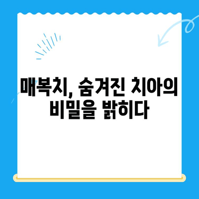 매복치 원위치 방법| 성공적인 치료를 위한 모든 것 | 매복치, 치아 교정, 치과 수술, 치료 과정, 주의 사항