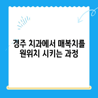 경주 치과에서 매복치 원위치| 성공적인 치료를 위한 안내 | 매복치, 치아 이동, 치과 치료, 경주 치과