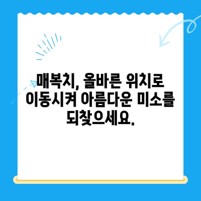 경주 치과에서 매복치 이동| 올바른 위치로 안전하게 | 매복치, 치아 이동, 경주 치과, 치과 상담, 치아 교정