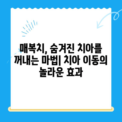 경주 치과| 매복치, 본래 자리로 이동하는 치료 과정 | 매복치, 치아 이동, 경주 치과 추천